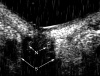 Figure 19