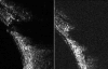 Figure 22