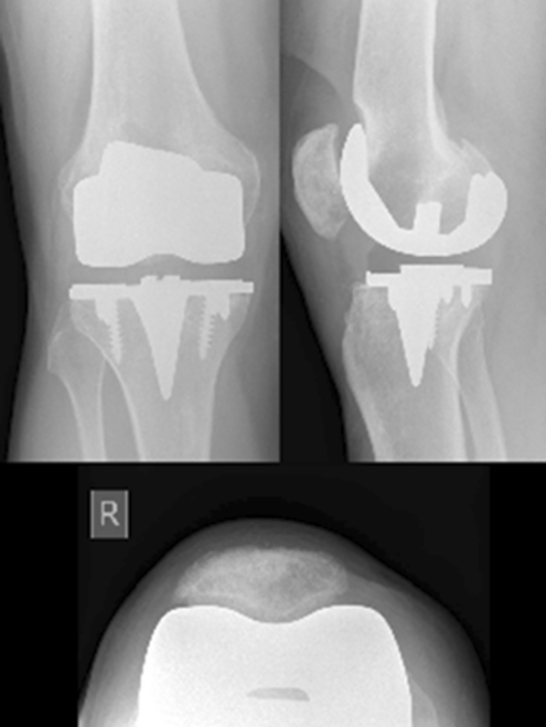 Fig. 3