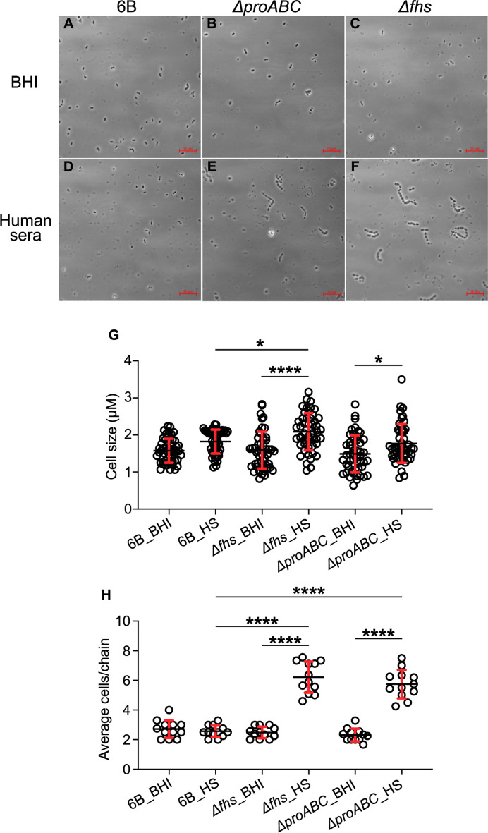 Microscopy of bacterial cells in BHI and human sera. The first graph shows cell size (μM) in both media, while the second graph depicts average cells per chain. Significant differences highlight how media affects bacterial morphology.