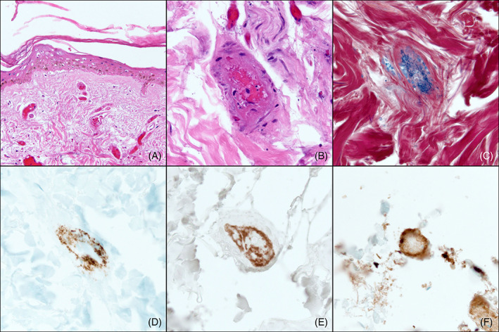 FIGURE 3