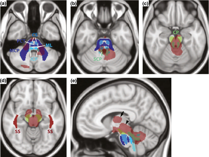 FIGURE 4