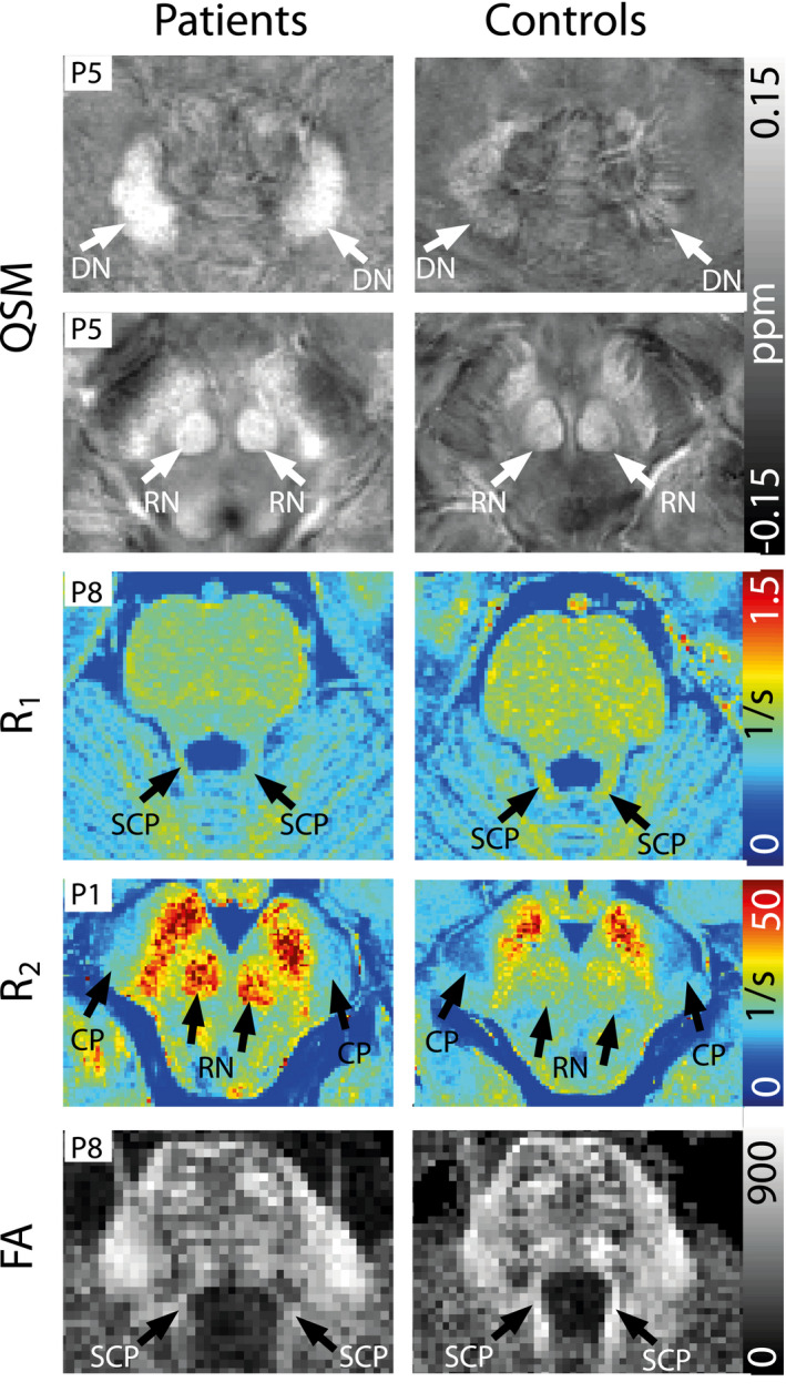 FIGURE 3