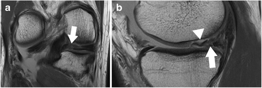 Fig. 11