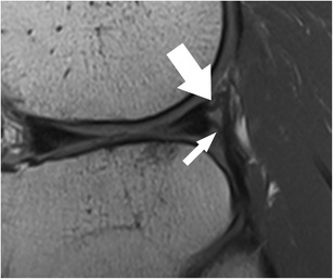 Fig. 16