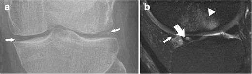 Fig. 12