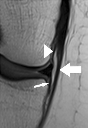 Fig. 14