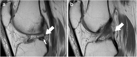 Fig. 19