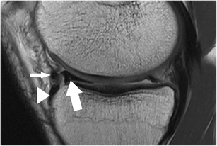 Fig. 21