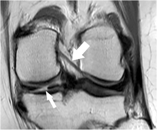 Fig. 17