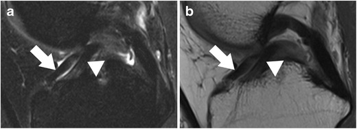 Fig. 22