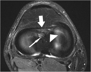 Fig. 10