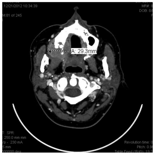 Figure 12