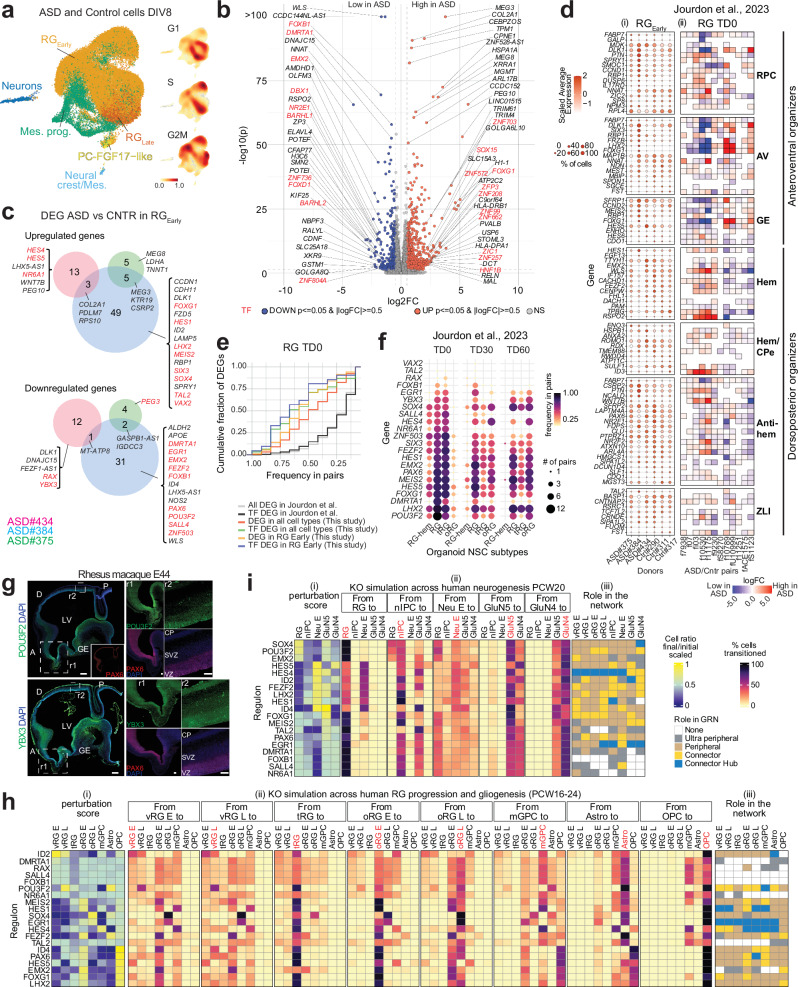 Early developmental origins of cortical disorders modeled in human Early developmental origins of cortical disorders modeled in human