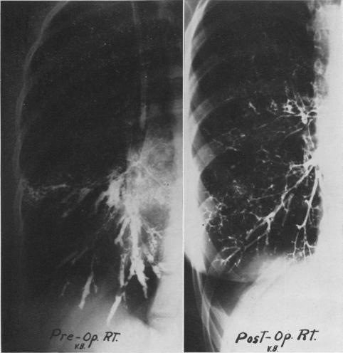 Fig. 6A.