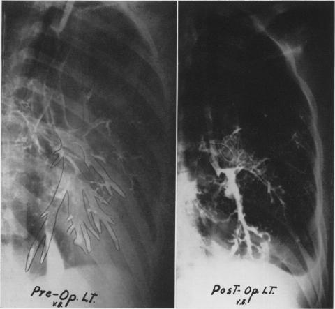 Fig. 6B.