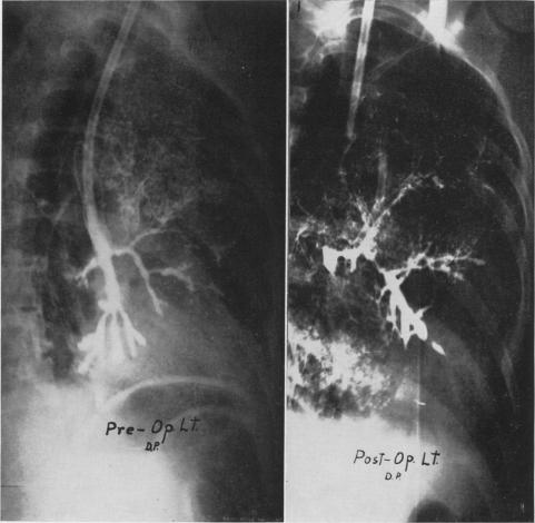 Fig. 5B.