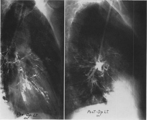 Fig. 4B.