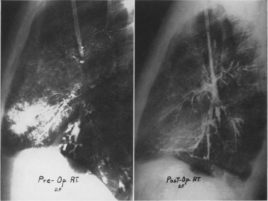 Fig. 5A.