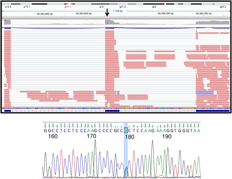 Fig 3