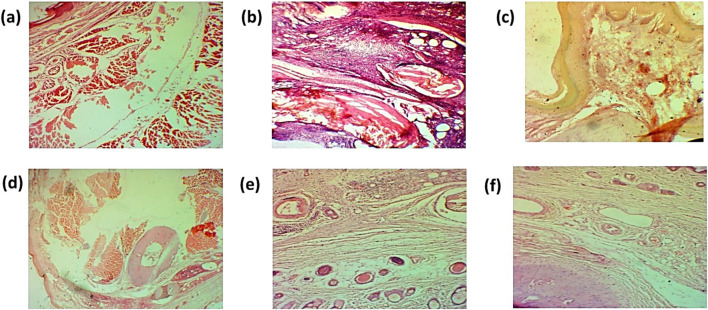 FIGURE 17