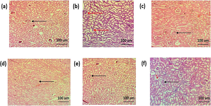 FIGURE 16