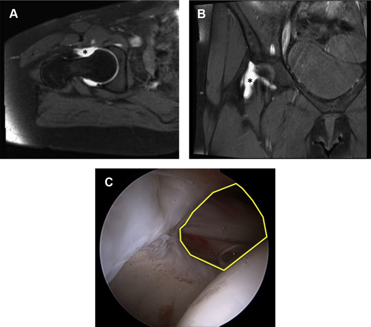 Fig 2