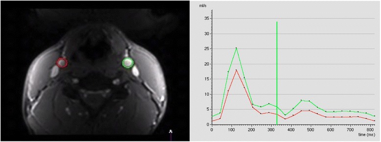 Fig. 3