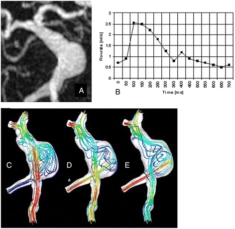 Fig. 13