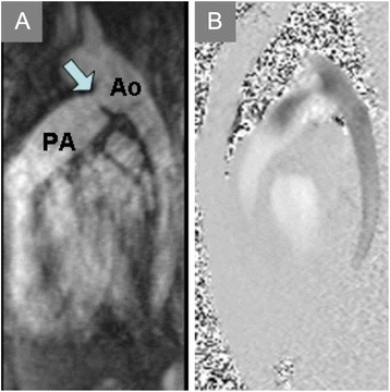 Fig. 10