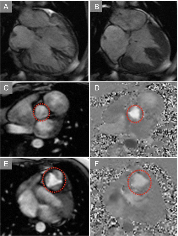 Fig. 11