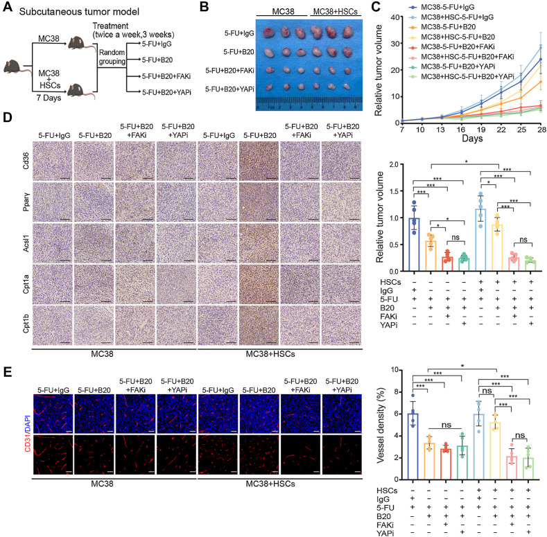 Figure 8. FAK and YAP inhibition enhances the efficacy of anti-VEGF therapy. A, Schematic representation of HSC/MC38 coinjection subcutaneous tumor models used in B–E. MC38 cells (0.5×106) were subcutaneously injected with or without primary murine HSCs (0.5×106) into C57BL/6 mice. After 7 days, mice were treated with 5-FU+IgG, 5-FU+B20, 5-FU+B20+FAKi, or 5-FU+B20+YAPi (5-FU, 50 mg/kg; B20, 5 mg/kg; FAKi, 5 mg/kg; YAPi, 10 mg/kg; twice a week, 3 weeks). B, Representative images of subcutaneous tumors of mice treated with indicated treatment. C, Relative tumor growth curves (top) and relative tumor volume (bottom) of subcutaneous tumors with indicated treatment (one-way ANOVA; n = 5 per group). D, Representative IHC images of serial sections of subcutaneous tumors of mice with indicated treatment. Scale bar, 100 μm. E, Representative immunofluorescence images (left) showing tumor vessels (stained for CD31) and quantification of vessel density (right) in subcutaneous tumors with indicated treatment. Scale bar, 50 μm (one-way ANOVA; n = 5 per group). Data are graphed as the mean ± SD. ns, not significant; P > 0.05; *, P < 0.05; **, P < 0.01; ***, P < 0.001. (A, Created with BioRender.com.)