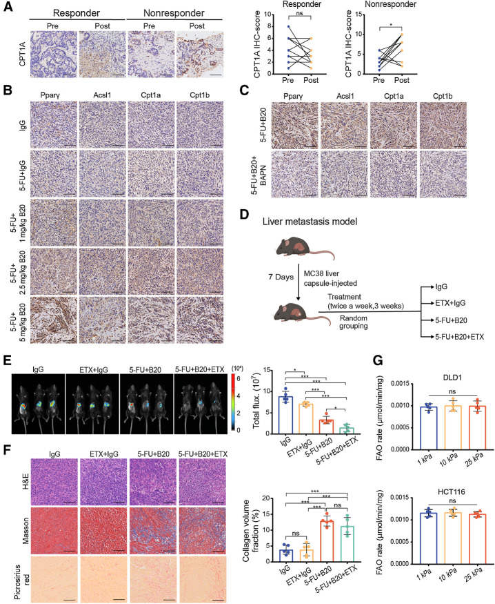 Figure 2. Anti-VEGF therapy-induced ECM deposition in liver metastases is associated with activation of FAO metabolism. A, Left, representative IHC images showing CPT1A expression in liver metastases from colorectal cancer patients before and after receiving chemotherapy and bevacizumab treatment. Right, IHC scores of CPT1A of intraindividual comparisons in paired samples (two-tailed paired t test; n = 10 per group). B, Representative IHC images on serial sections of MC38 liver metastases of mice with indicated treatment. C, Representative IHC images on serial sections of MC38 liver metastases of mice with indicated treatment. D, Schematic representation of the liver metastasis models used in E and F. Mice were given treatment with IgG, etomoxir (ETX) +IgG, 5-FU+B20 or 5-FU+B20+ETX (5-FU 50 mg/kg, B20 5 mg/kg; etomoxir 15 mg/kg; twice a week, 3 weeks). E, Representative in vivo bioluminescent images (left) and quantification of bioluminescent signals (right) of liver metastases in mice treated with indicated treatment (one-way ANOVA; n = 5 per group). F, Representative hematoxylin and eosin (H&E), Masson, picrosirius red images (left) on serial sections and quantification of collagen volume fraction (right) showing ECM deposition in liver metastases in mice with indicated treatment (one-way ANOVA; n = 5 per group). G, FAO rate of DLD1 and HCT116 cells cultured on 1 kPa, 10 kPa, and 25 kPa polyacrylamide hydrogels (one-way ANOVA; n = 5 independent experiments). Data are graphed as the mean ± SD. Scale bar, 100 μm. ns, not significant; P > 0.05; *, P < 0.05; ***, P < 0.001. (D, Created with BioRender.com.)