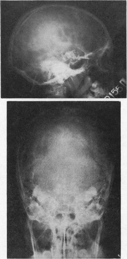 Fig. 7a and b