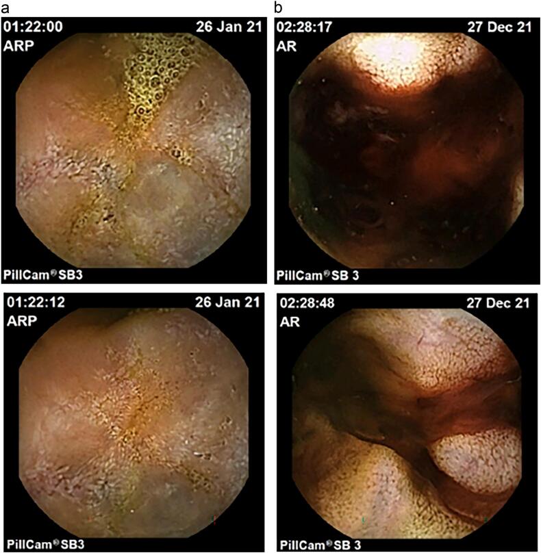 Fig. 1