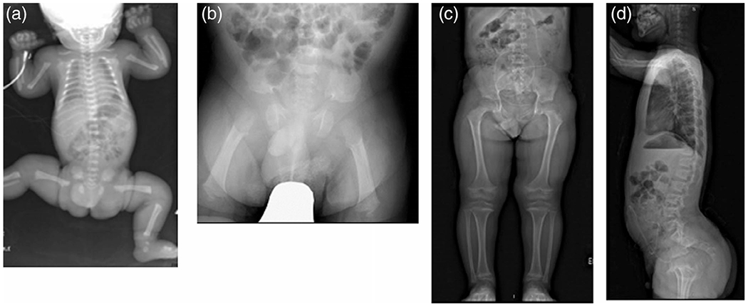 FIGURE 1