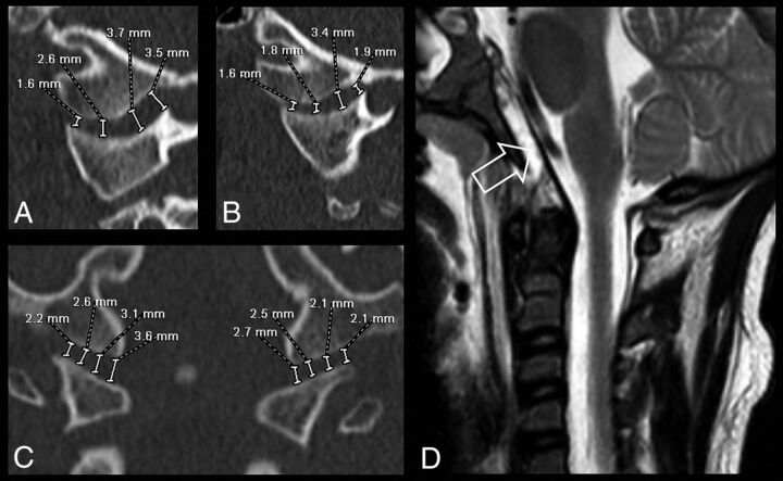 Fig 2.