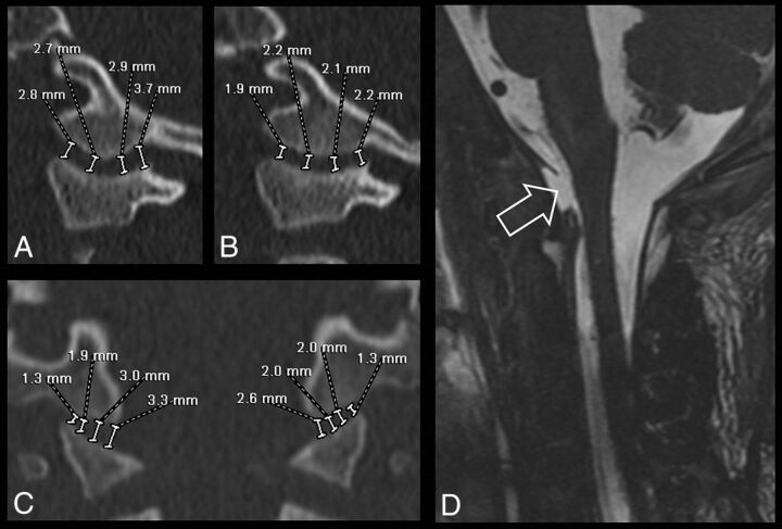 Fig 3.