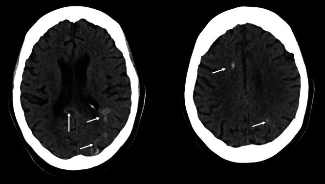 FIG 2.