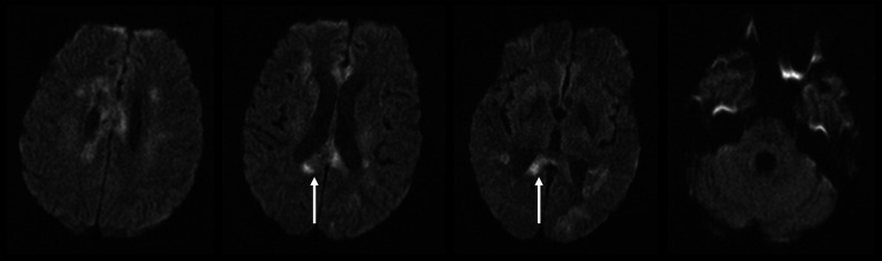 FIG 3.