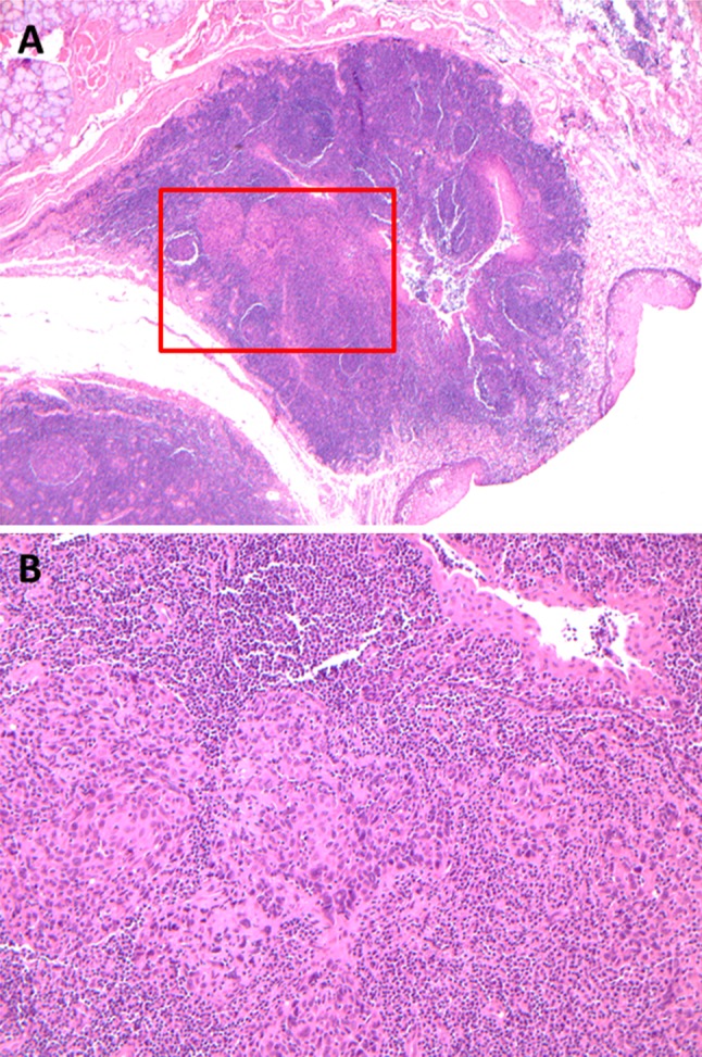 Fig. 1