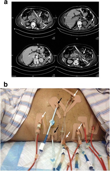 Fig. 3