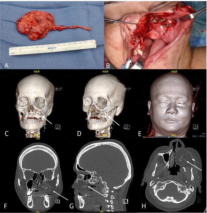 Figure 4