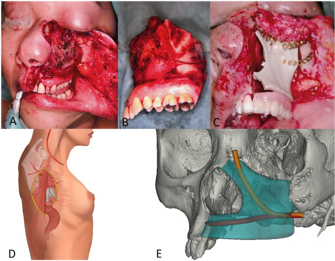 Figure 1