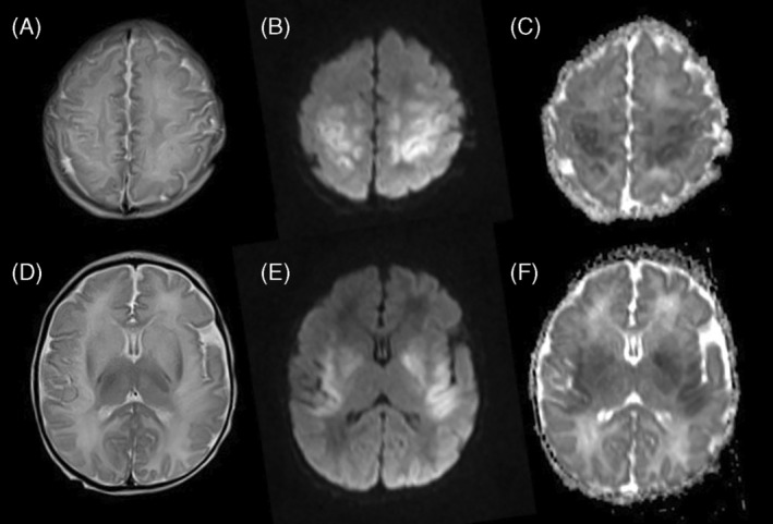 FIGURE 2