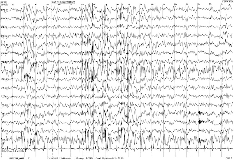 Fig. 1