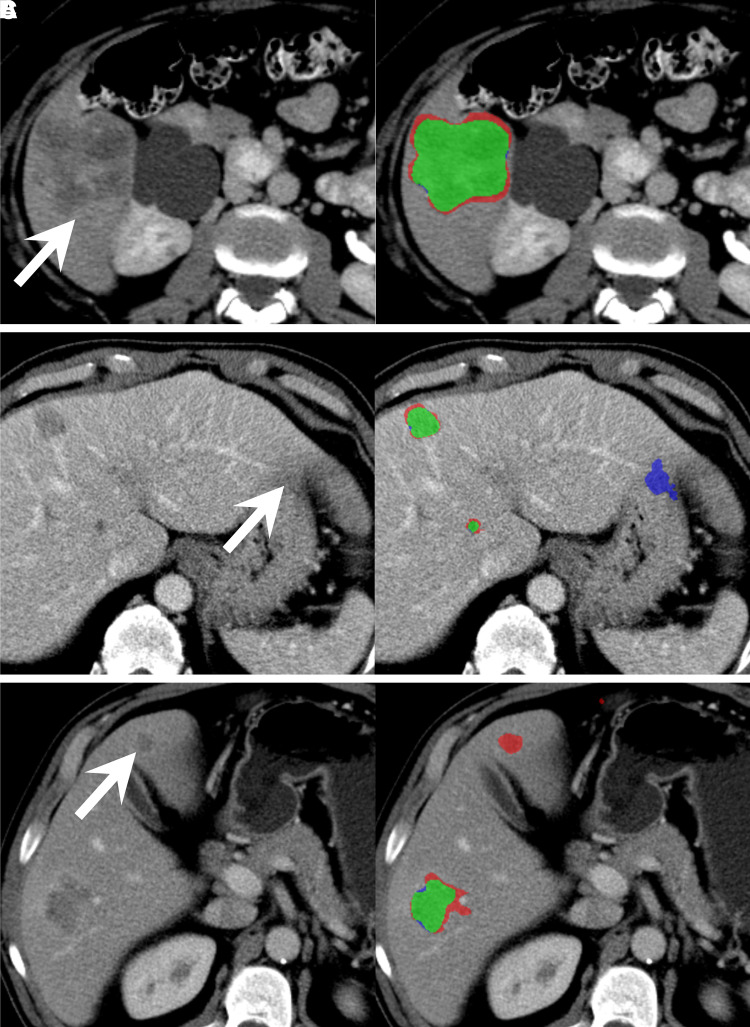 Figure 3: