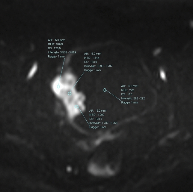 Fig. 2