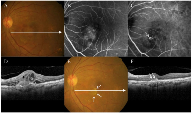 Fig. 3