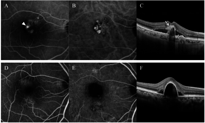 Fig. 1